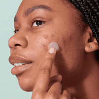 Mighty Patch™ for Early-Stage Blemishes